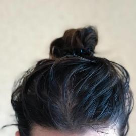 Greasy Hair